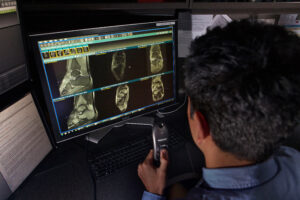 A radiologist speaks into a dictaphone while looking at x-rays on a computer screen.